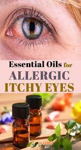 Essential Oils For Allergic Itchy Eyes Essentialoils Allergic Eyes Itchy Http Allergy Symptoms O Itchy Eyes Allergies Itchy Eyes Essential Oils Allergies