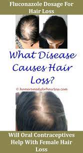 Would you have hair loss when taking hydrochlorothiazide? Homeopathic Remedy For Hair Loss In Females Hair Loss Stress Related Hair Loss Grow Back Oil For Wi Stress Related Hair Loss Stress Hair Loss Hair Loss Reasons