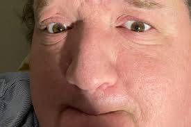 Fundraiser by Michael Lentz : Medical Expense Assistance