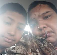 Texas boy, 11, saves family from fiery crash by beating flames with his  hands