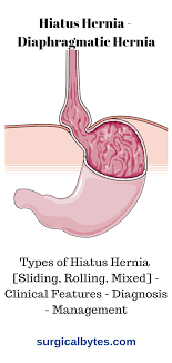 Hiatus Hernia Diaphragmatic Hernia Hiatus Hernia Diagnosis Clinic