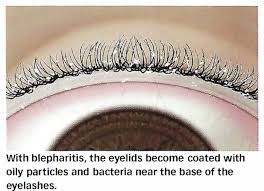 Image result for Blepharis involucrata