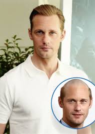 Meet the cast of vikings on the history channel. Actor Alexander Skarsgard Goes Bald Overnight