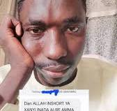 Maganin Basir, Zafin DUBURA. ayi share Saboda Jama'a su ...