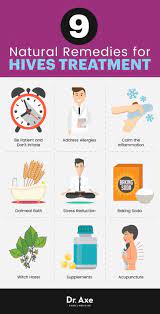 Hives Treatment: 9 Natural Remedies For Soothing Relief - Dr. Axe