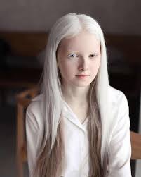 How is blonde hair mutation activated? Amina Ependieva A Girl Who Inherited Two Genetic Mutations And Exceptional Beauty In 2020 Albino Girl Albinism Portrait