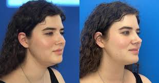 Banerji Plastic Surgery