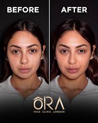 Sun, sea and pure bliss in 🇪🇸 #dradam #relax #reflect #enjoy #spain  #marbella #doctor