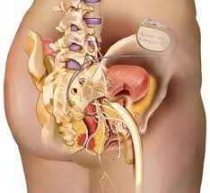 Image result for Fecal Incontinence