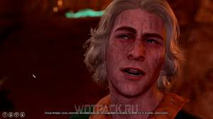 Free the Artist in Baldur's Gate 3: How to Rescue Oscar Fevras