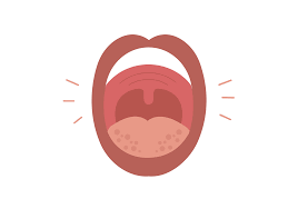 Swollen Mouth 7 Reasons For Mouth Swelling Buoy