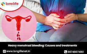 Image result for Menstrual Bleeding