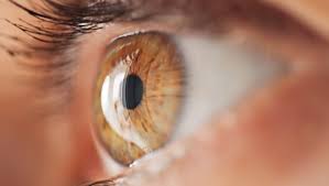 I'm arielle, and i recently got lasik eye surgery. Crstoday How Should I Manage The 10 Year Post Lasik Patient Who Is Now Unhappy With His Or Her Vision