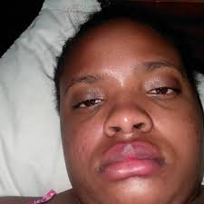 Stream Every Day It Be Burnin' And Itchin' by sweetcrazylover