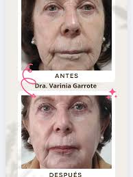 Clinica Estética y Cirugía Oculoplástica Ceomedica