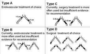 Aortoiliac Disease Wikidoc