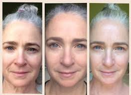 My husband didn't want me to make this post but I had to because a lot of  women struggle with this!! I am 58 and will never go to any dermatologist or