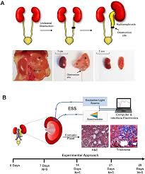 Causes of kidney cancer the causes of kidney cancer are not known, but factors that put some people at higher risk are: Towards Minimally Invasive Quantitative Assessment Of Chronic Kidney Disease Using Optical Spectroscopy Scientific Reports