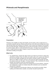 Image result for paraphimosis