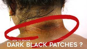 We did not find results for: How To Get Rid Of Dark Neck Tamil Beauty Tips Remedy For Lighten Dark Neck Youtube