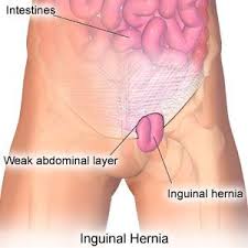 Pin On Royalty Surgical Center Procedure Details