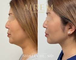 Shirley Hu, M.D. (@drshirleyhu) • Instagram photos and videos