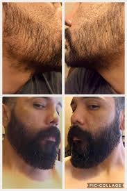 Using minoxidil speeds beard growth and development and allows faster results! This Stuff Works Fellas Keep At It Minoxbeards