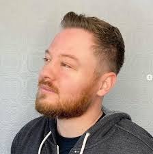 Accessory Dwelling Units (ADUs)