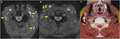 Image result for Incidental Imaging Finding