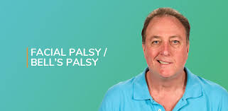 Signs and symptoms of bell's palsy. Facial Palsy Bell S Palsy Avoid Synkinesis Physioline
