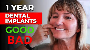 Can a Smile Makeover Improve Self Esteem? Don't Miss This Story