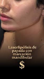 Dr. Fernando Patron (@dr._fernando_patron) • Instagram photos and videos