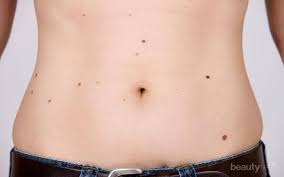 Terkadang beberapa orang mengalami kondisi tulang rusuk yang kaku, terutama pada daerah dada. Ada Tahi Lalat Di Payudara Hmm Ternyata Ini Dia Penyebab Munculnya