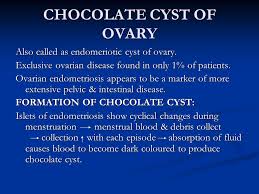 Initial treatment without a conclusive diagnosis may be advised the way to confirm a diagnosis of endometriosis is to have a. Endometriosis Dept Of Obs Gynaec Amc Ppt Video Online Download