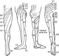 Pin On Living With Spinal Stenosis