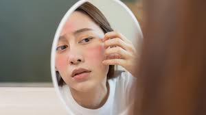 Your Guide To Adding Azelaic Acid Into Your Skincare Routine