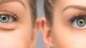 Prp and prf are the best way to help your body restore bone. Augenringe Entfernen Auch Ohne Op Dr Konig Koln Klinik Am Ring