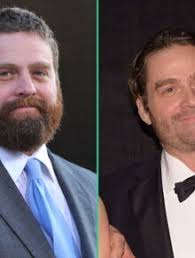 PHOTOS L'incroyable perte de poids de Boy George