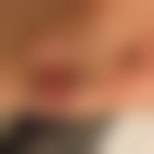 Why Does My Piercing Smell Bad?