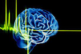 La muerte encefálica se define como el cese irreversible en las funciones de todas las estructuras neurológicas intracraneales, tanto de los hemisferios cerebrales como del troncoencéfalo. Concepto De Muerte Encefalica Home Facebook