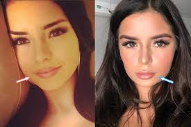 Demi rose popular british instagram model , she was one of the most popular model of 2016 , ex of tyga. Did Demi Rose Mawby Have Plastic Surgery Before After 2021