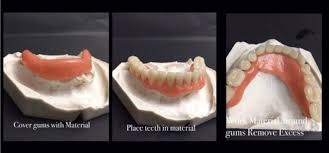Diy Denture Kit Full Denture Replace Missing Teeth Acrylic Resin Upper Lower Shade A1 A2 Denture Kit In 2020 Affordable Dentures Denture Fix Teeth