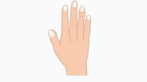 Welche untersuchungen macht der arzt, um sicher zu sein? Osteoarthritis In The Hands How It Can Lead To Pain In The Finger Joint Lime Medical Gmbh Lime Medical Gmbh