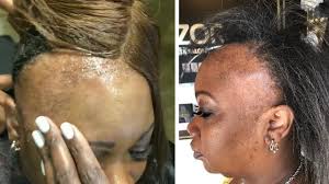 Who Did This Weaves Severely Damage Hair Amazing Hair Transformations Thining Hair Hair Transformation Damaged Hair
