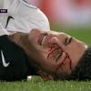 Dries mertens, belgian footballer franz mertens, german mathematician franz carl mertens. Https Encrypted Tbn0 Gstatic Com Images Q Tbn And9gcrimflyivtyqwlhhao7xo94ofhm0fpylsyefz7kjyp Scj2 Bjv Usqp Cau