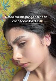 Cómo el Aceite de Coco puede Ayudar al Acné Facial