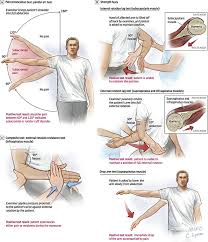 Image result for Shoulder Exam