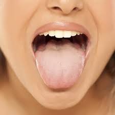 Image result for cancer tongue symptoms)