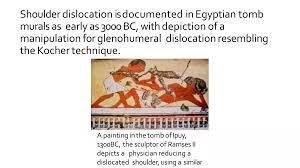 Image result for Shoulder Relocation Maneuvers