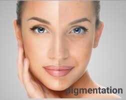 It is highly rich in vitamin c, oleic acid, and fatty acids5, all of which have benefits for skin rejuvenation and healing. Ayurvedic Treatment For Pigmentation On Face Health Benefit